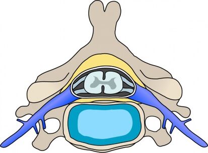 Protabius a csigolyában méhnyak osteochondrosissal
