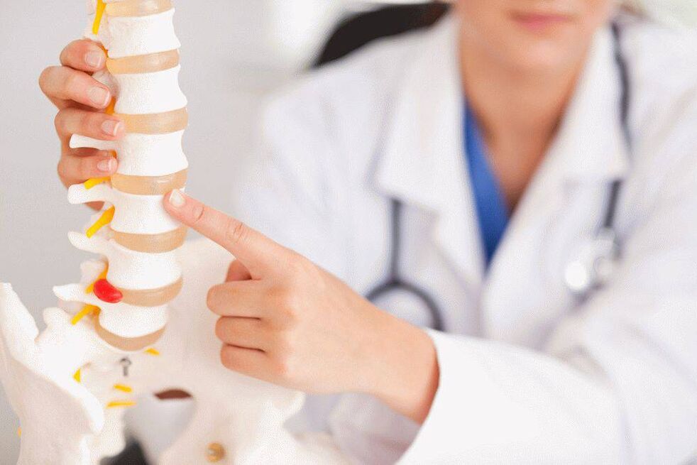 Orvos az osteochondrosisról és annak megelőzéséről